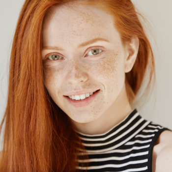 Gentle redhead girl smiling Elegant Smiles patient